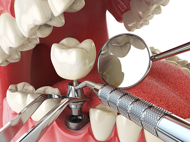 Best Broken Tooth Emergency  in East Sparta, OH